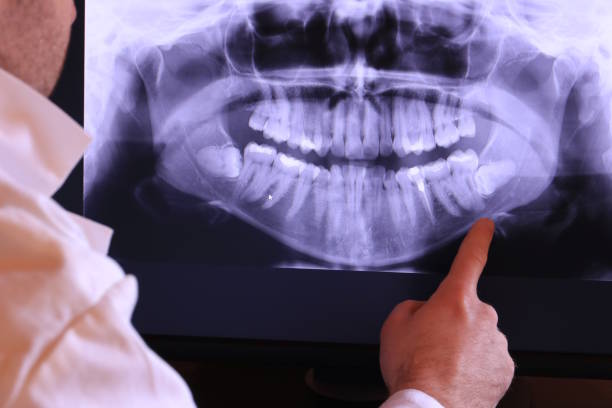 Best Emergency Dentist for Special Needs Patients in Dublin, TX