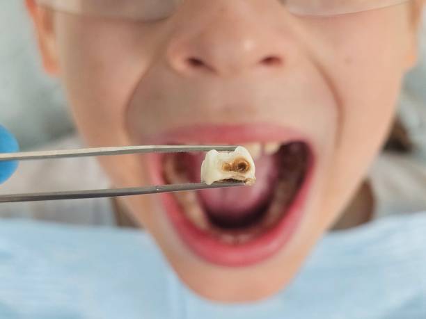 Best Orthodontic Emergency Dentist in Dublin, TX